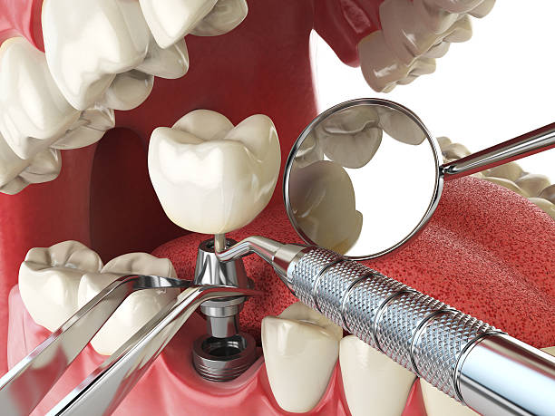Best Emergency Dental Services for Seniors in Charleroi, PA